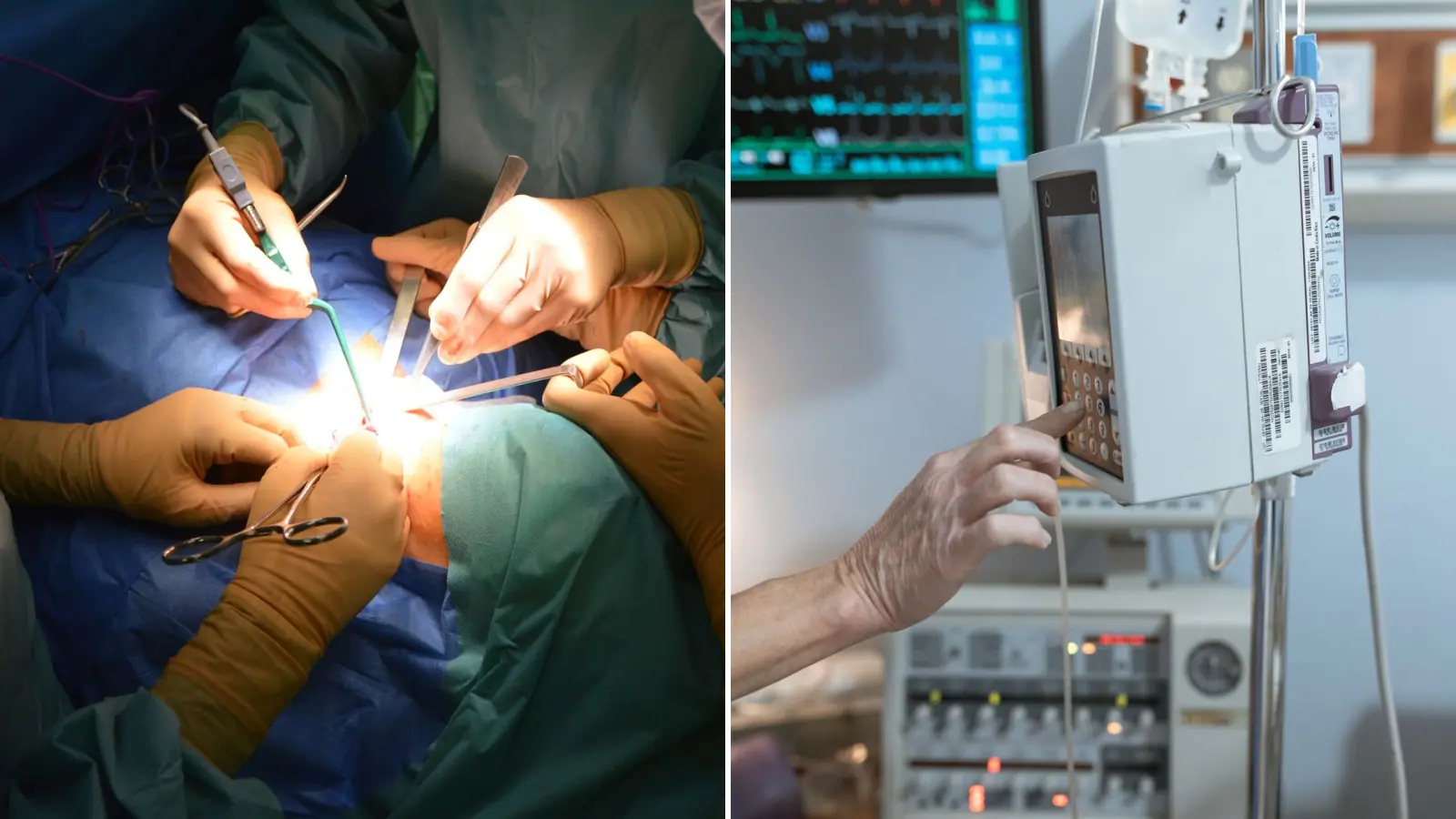 Burgas surgeons replace heart valve of 85-year-old through 3 cm incision