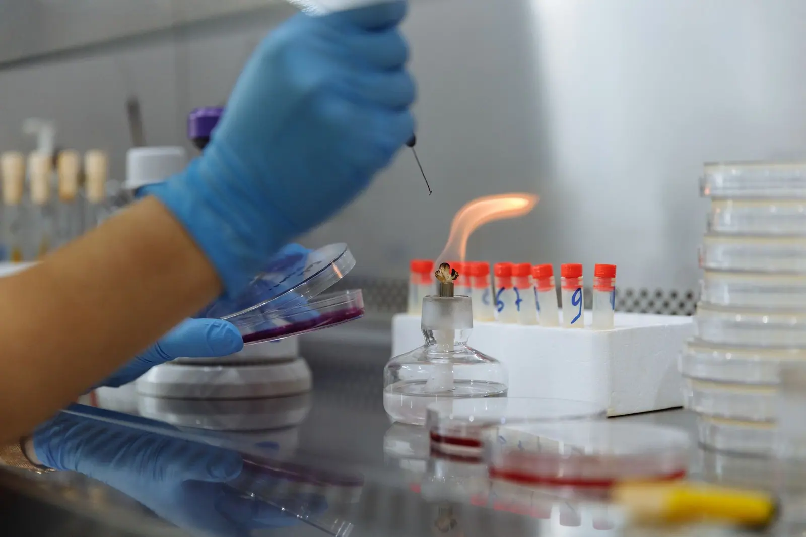 УМБАЛ Бургас вече открива с PCR вируса, причинил менингит или енцефалит
